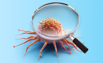 КТ-комплекс «Онкопоиск» — скидка 30%!