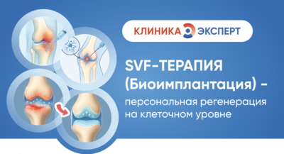 SVF-терапия (биоимплантация) в клинике Эксперт